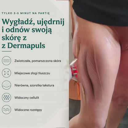 Dermapuls